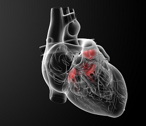 Аортокоронарное шунтирование